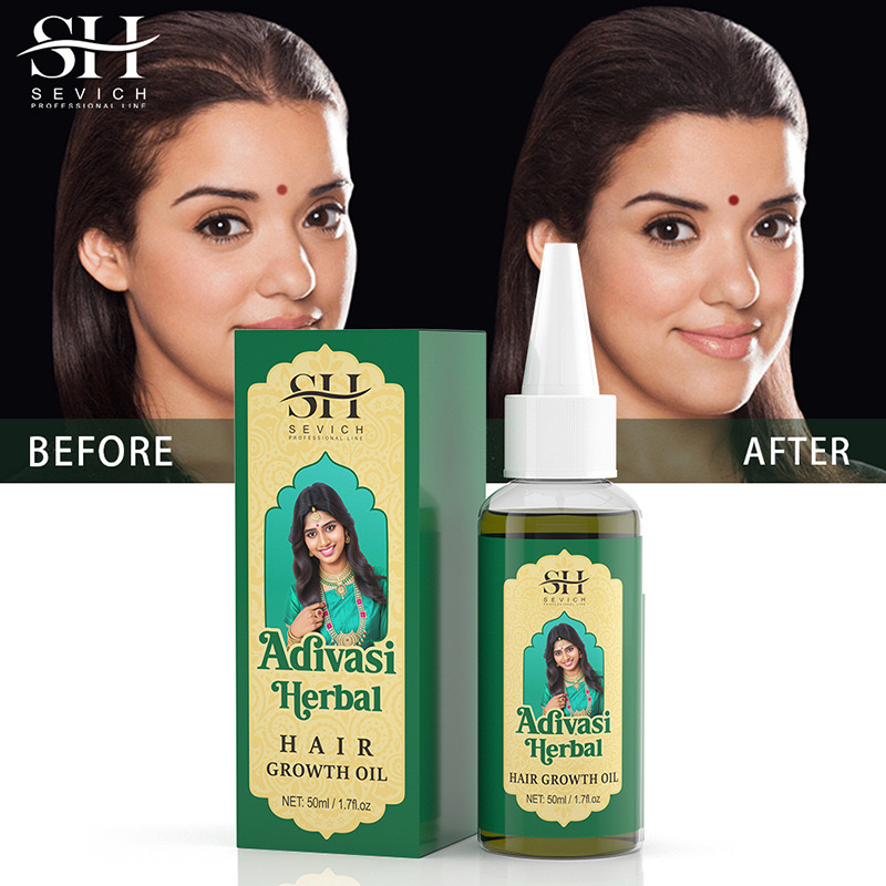 50ml original índia óleo adiva - Ayurvedic & Herbal Wellness Kits avaliação e preço